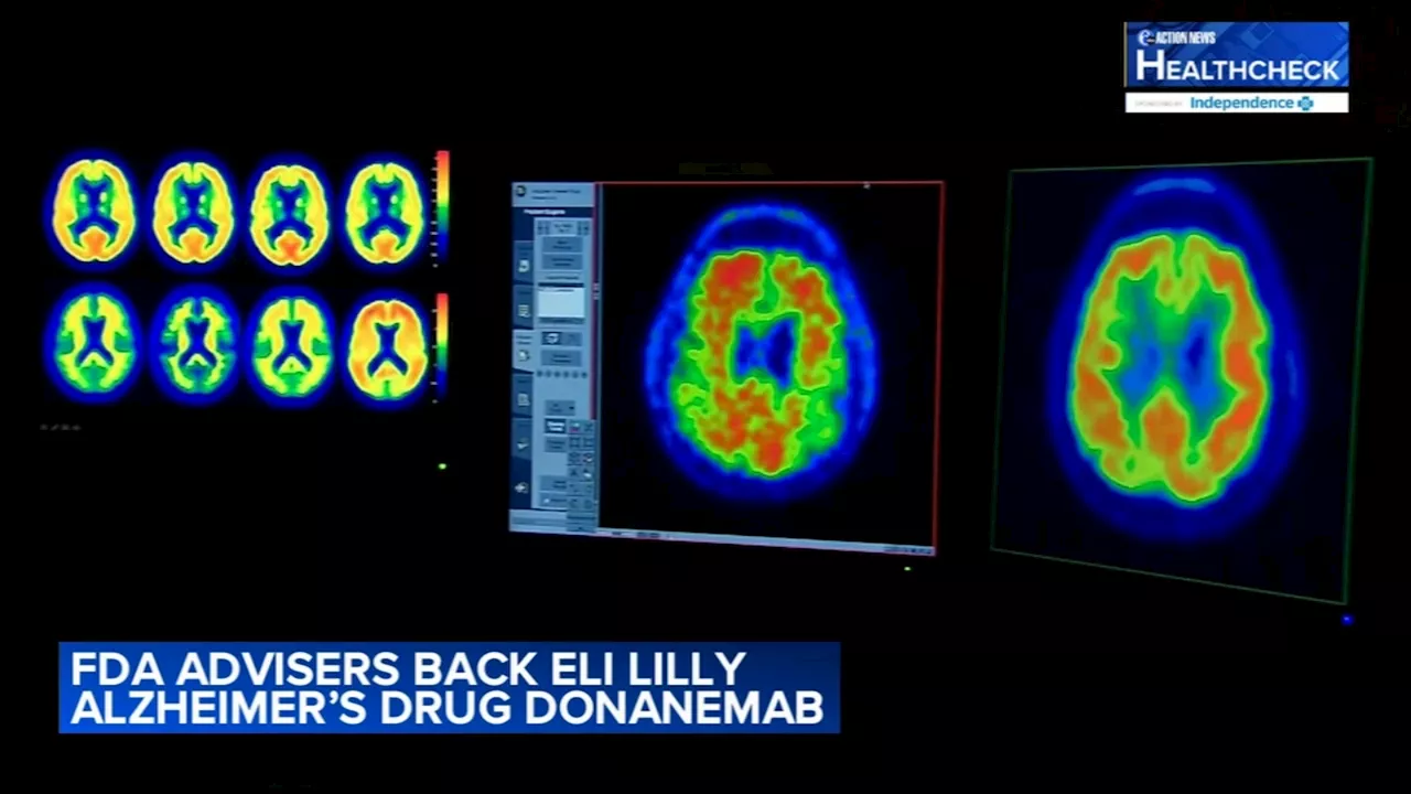 Alzheimer's drug that can slow disease gets backing from FDA advisers