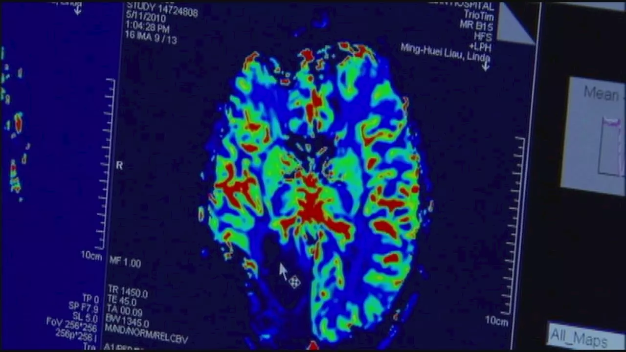 Northwestern Medicine achieves breakthrough in glioblastoma treatment