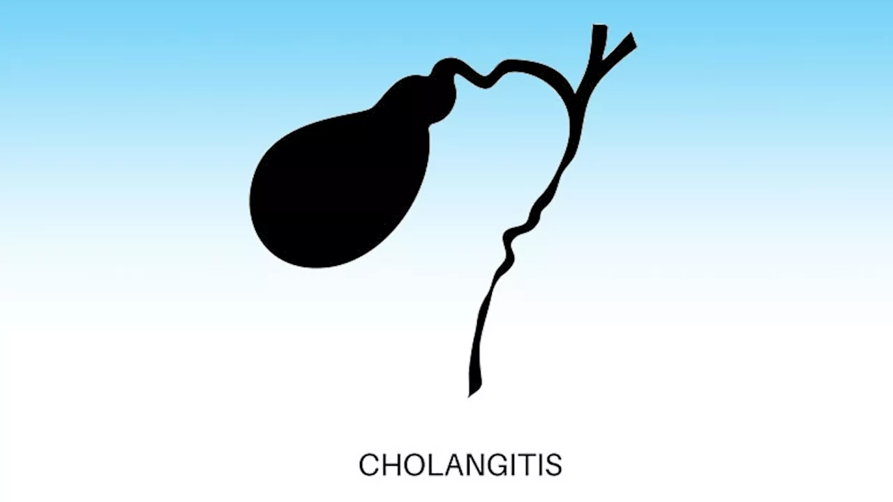 FDA OKs Iqirvo, First-in-Class PPAR Treatment for Primary Biliary Cholangitis