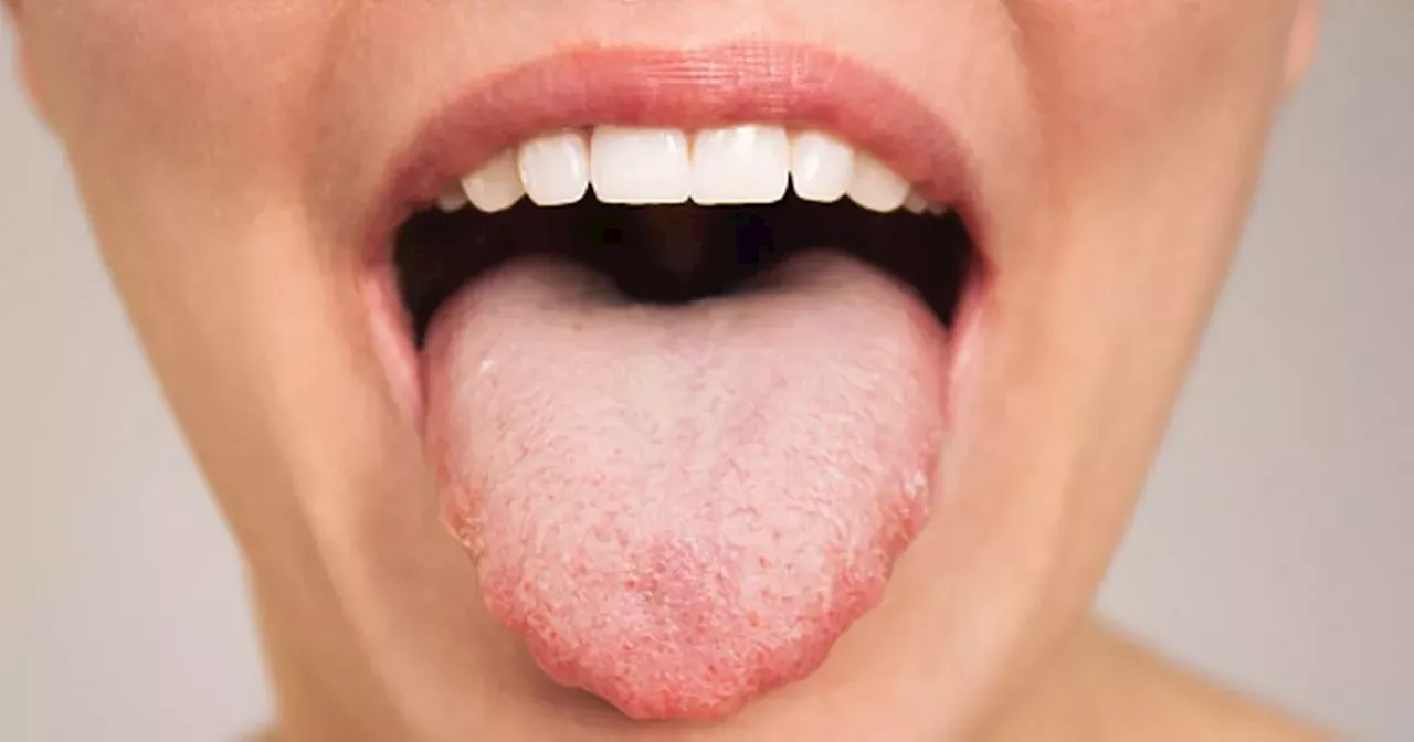 Doctor's simple tongue test to determine if you should be drinking coffee