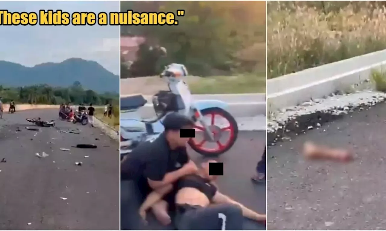 Viral Video Shows a Malaysian's Leg Allegedly Getting Torn Off During Crash Between Mat Rempits