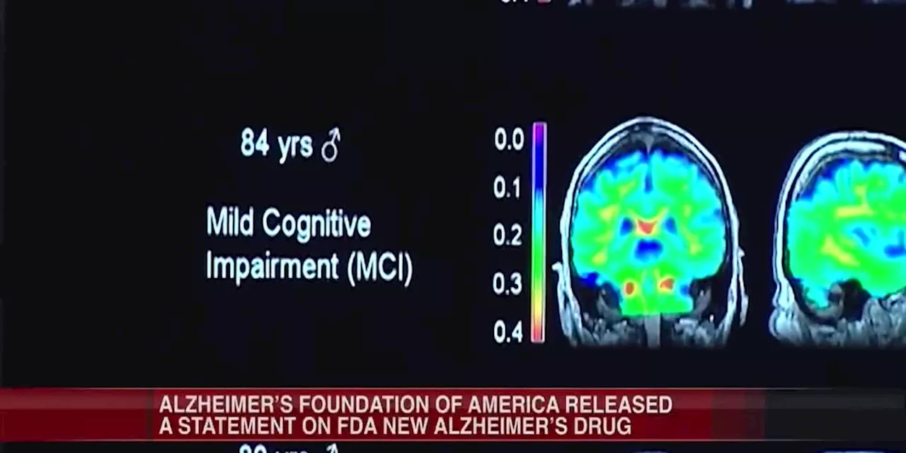 AFA responds to approval of Alzheimer’s Drug by FDA Advisory Committee