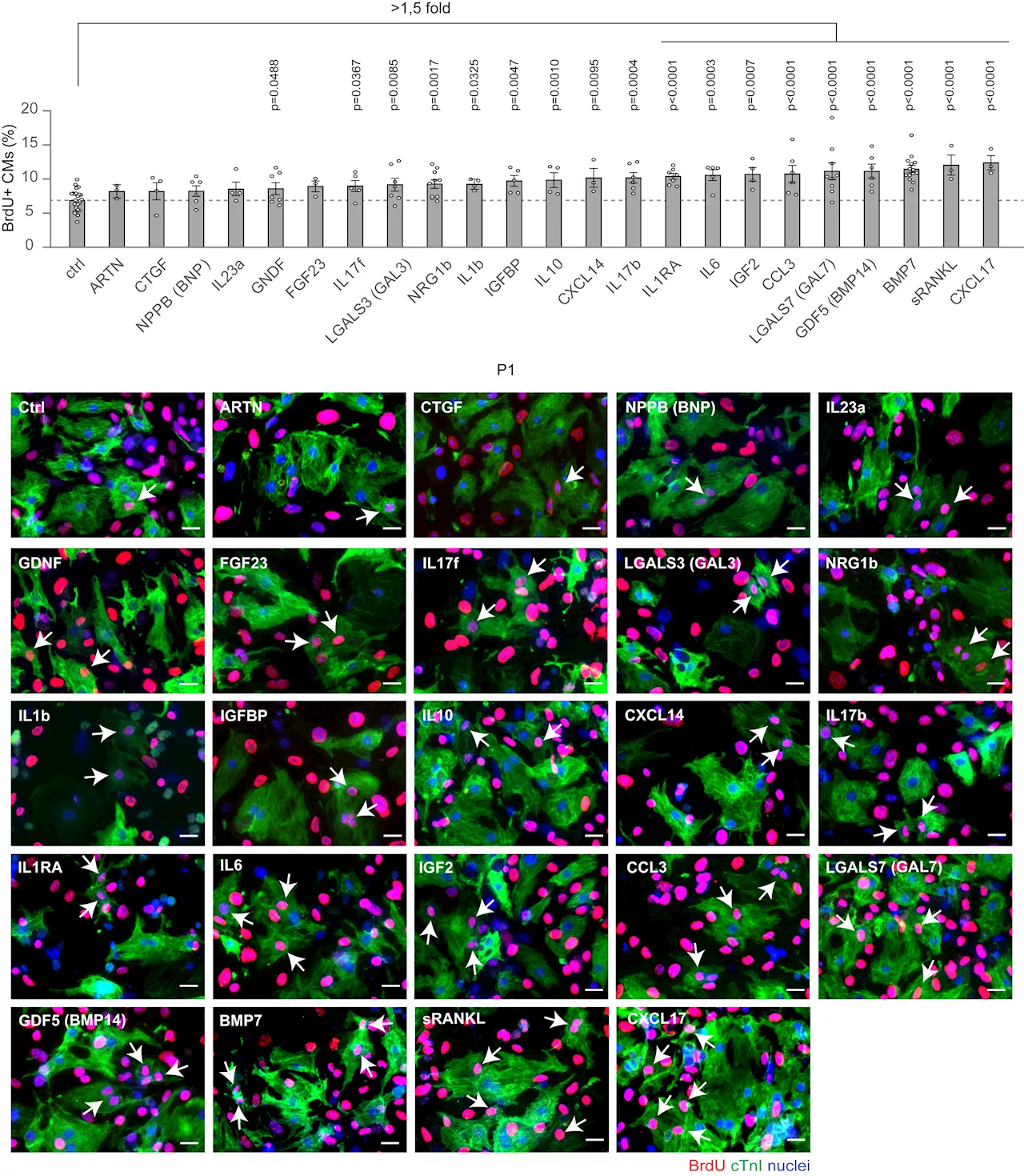 Heart regeneration: Researchers discover key role of growth factor