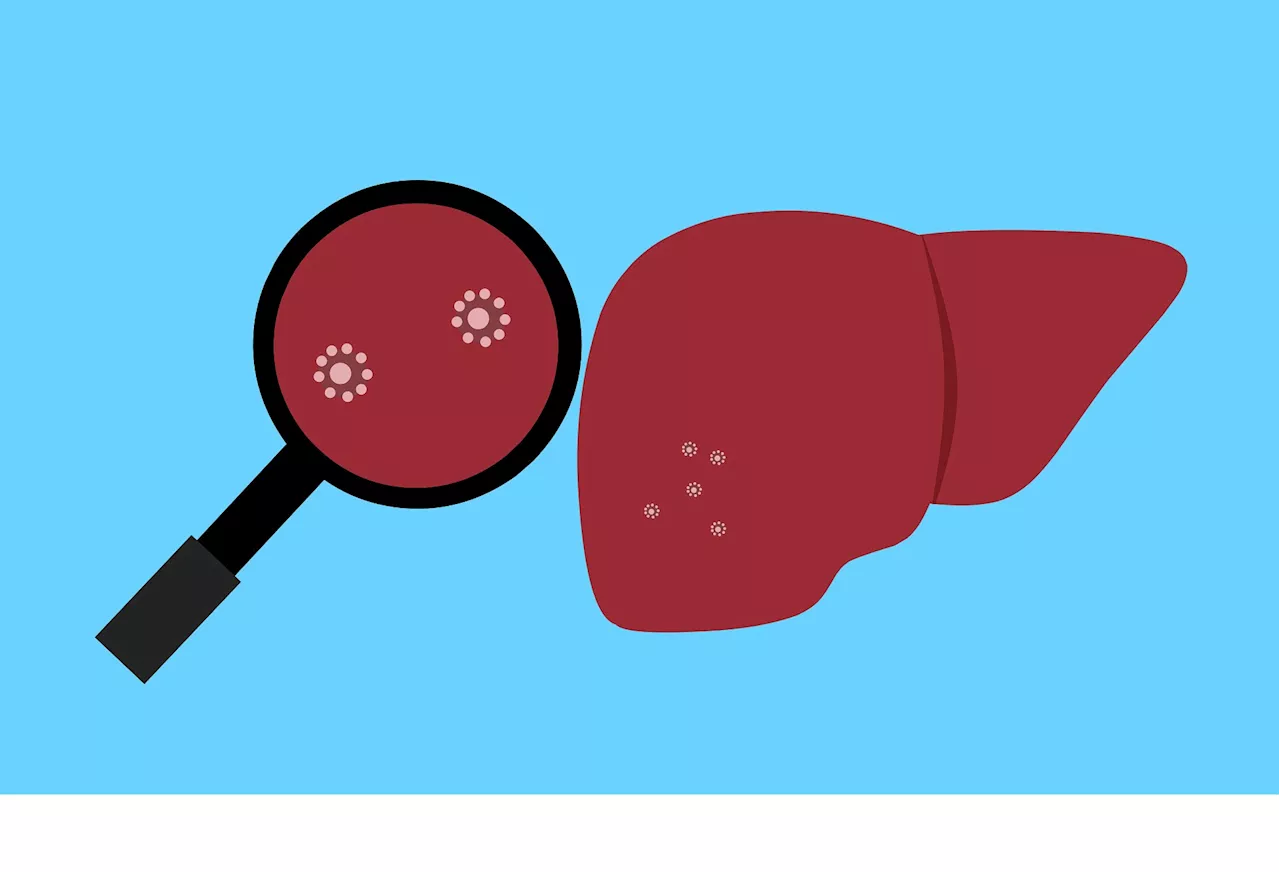 New thesis on biomarkers for hepatocellular carcinoma