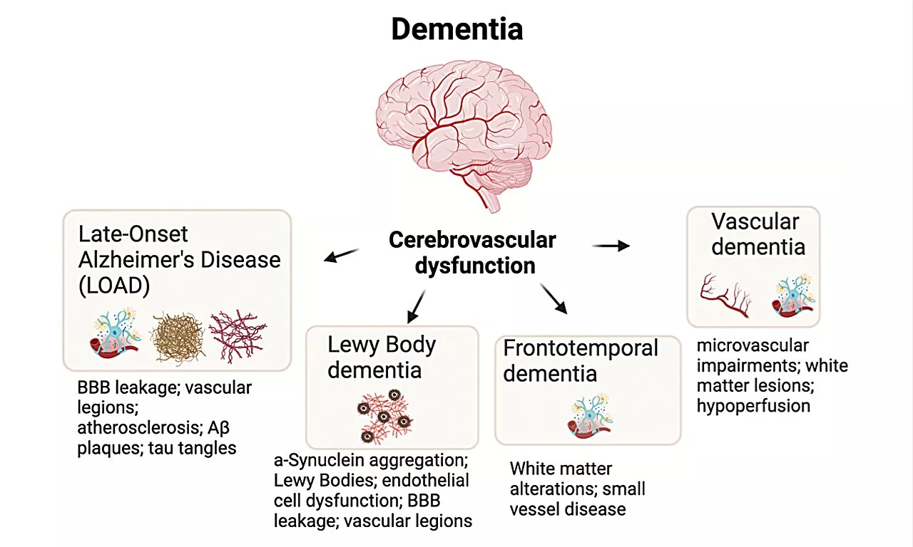 Researchers investigate the aging brain and peripheral vascular dysfunction