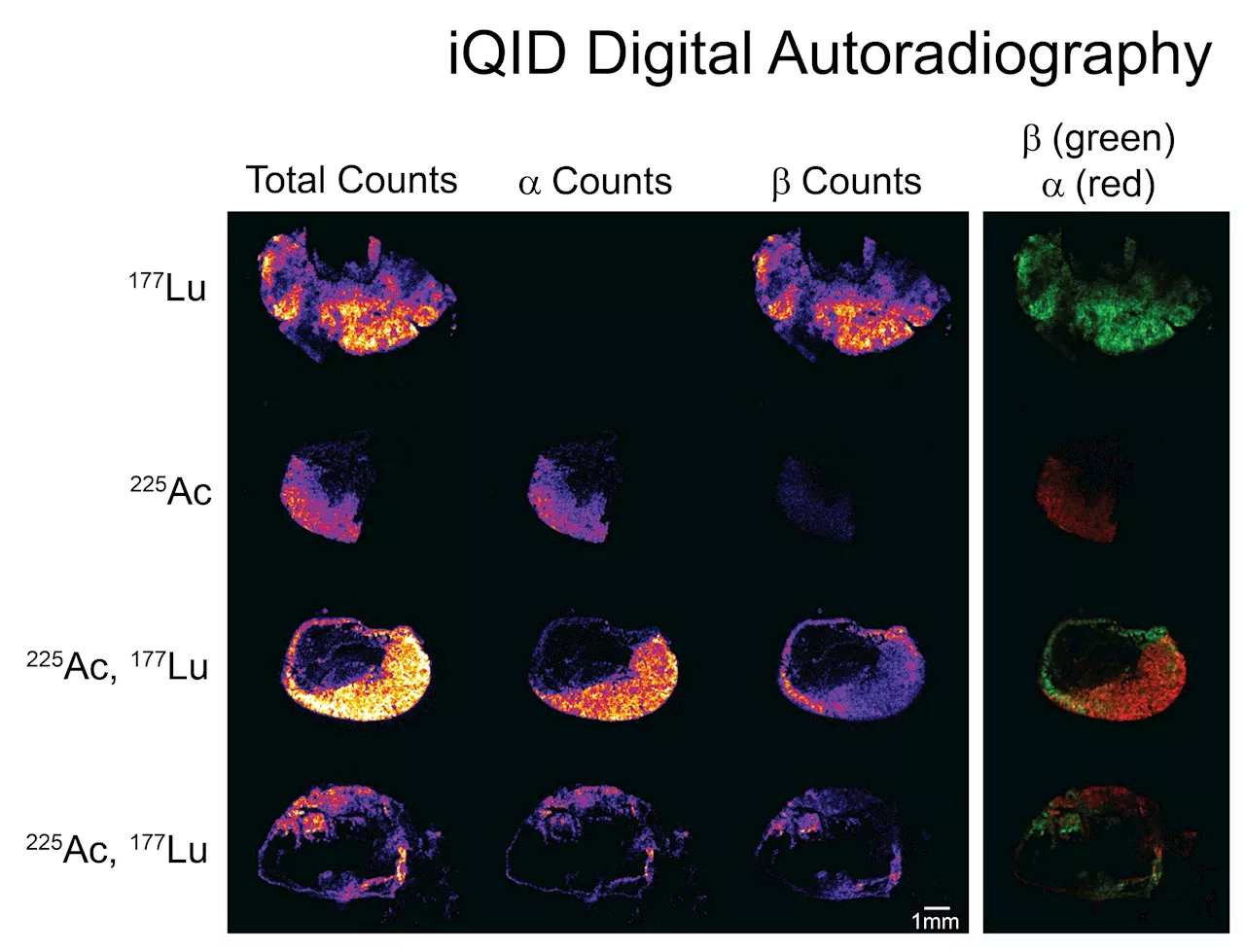 Study shows pre-targeted dual-isotope radionuclide therapy safe and effective in colorectal cancer