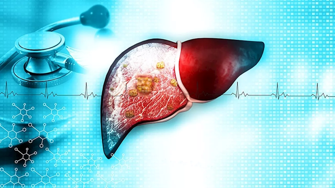 'Dramatic' Phase 2 Results for Survodutide in MASH, Fibrosis