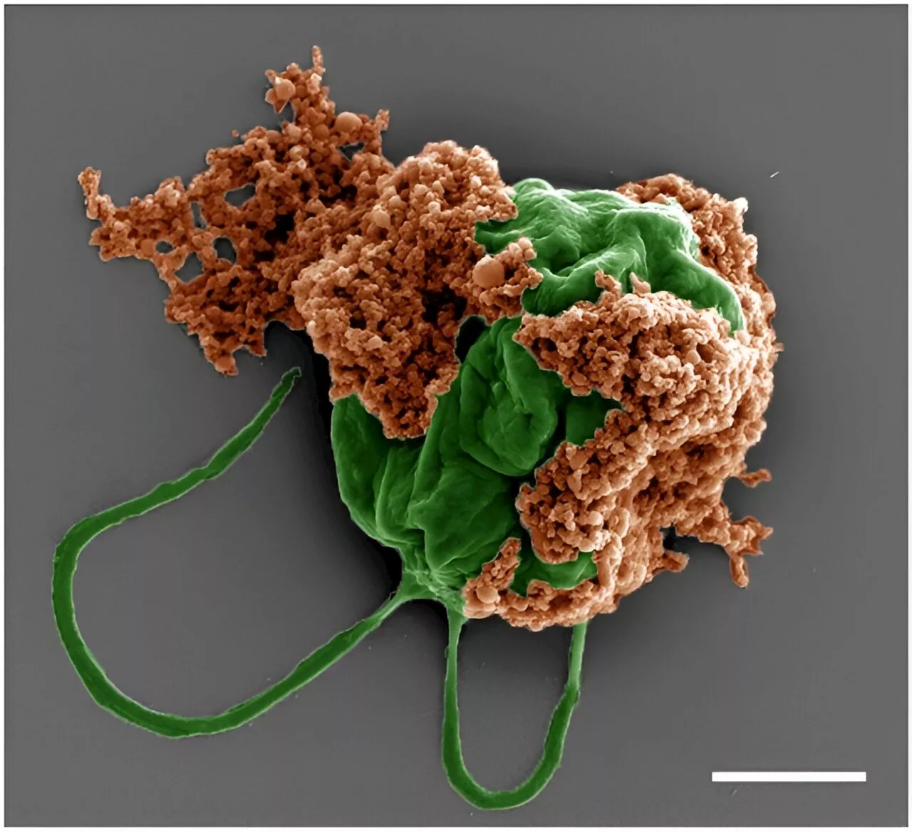 Swimming microrobots deliver cancer-fighting drugs to metastatic lung tumors in mice