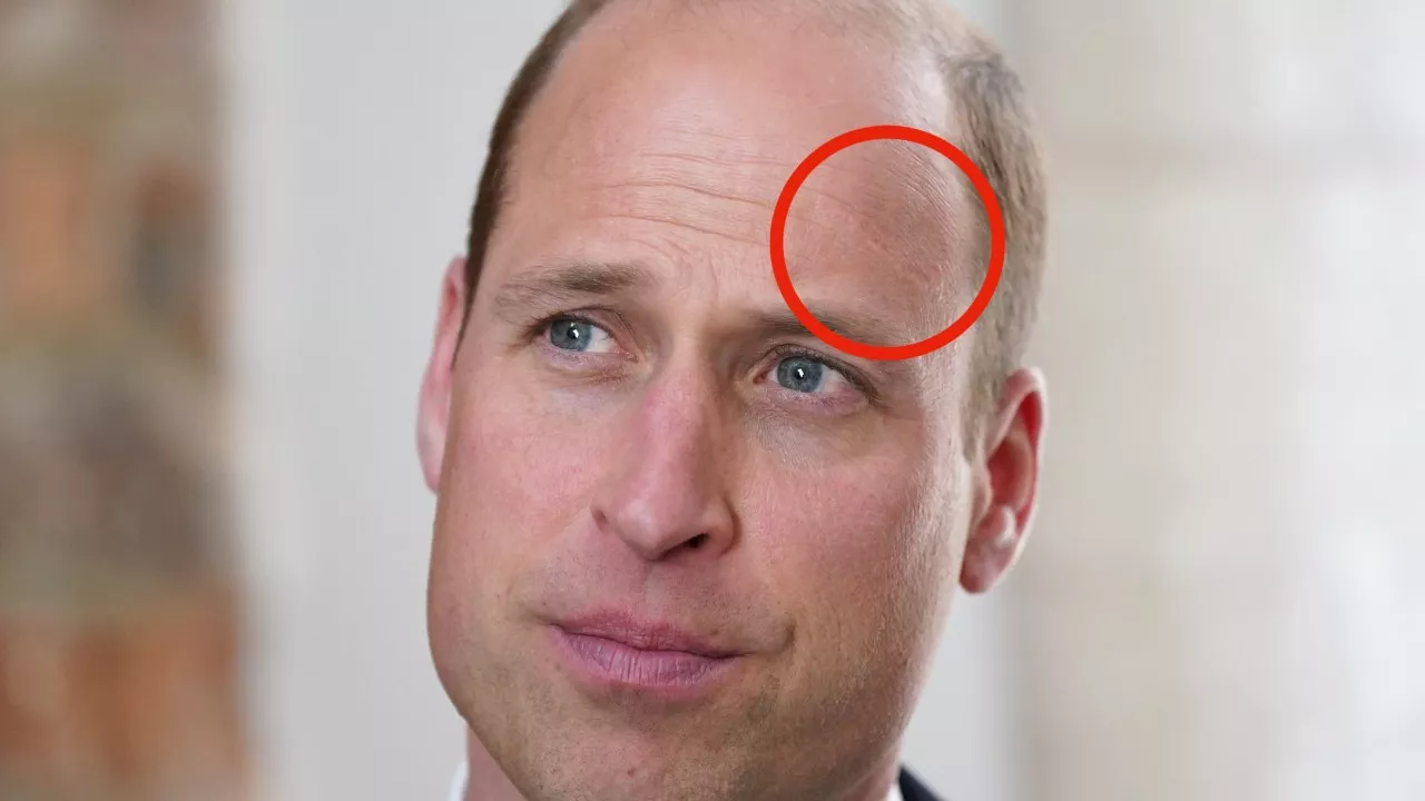 ‘Hit me in the head’: Prince William opens up about horror accident