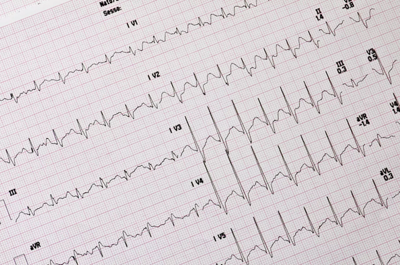 Al via un progetto per la prevenzione delle cardiopatie per 30 mila persone