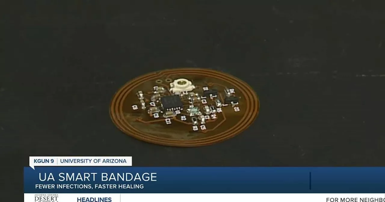 UA working on “smart bandage”