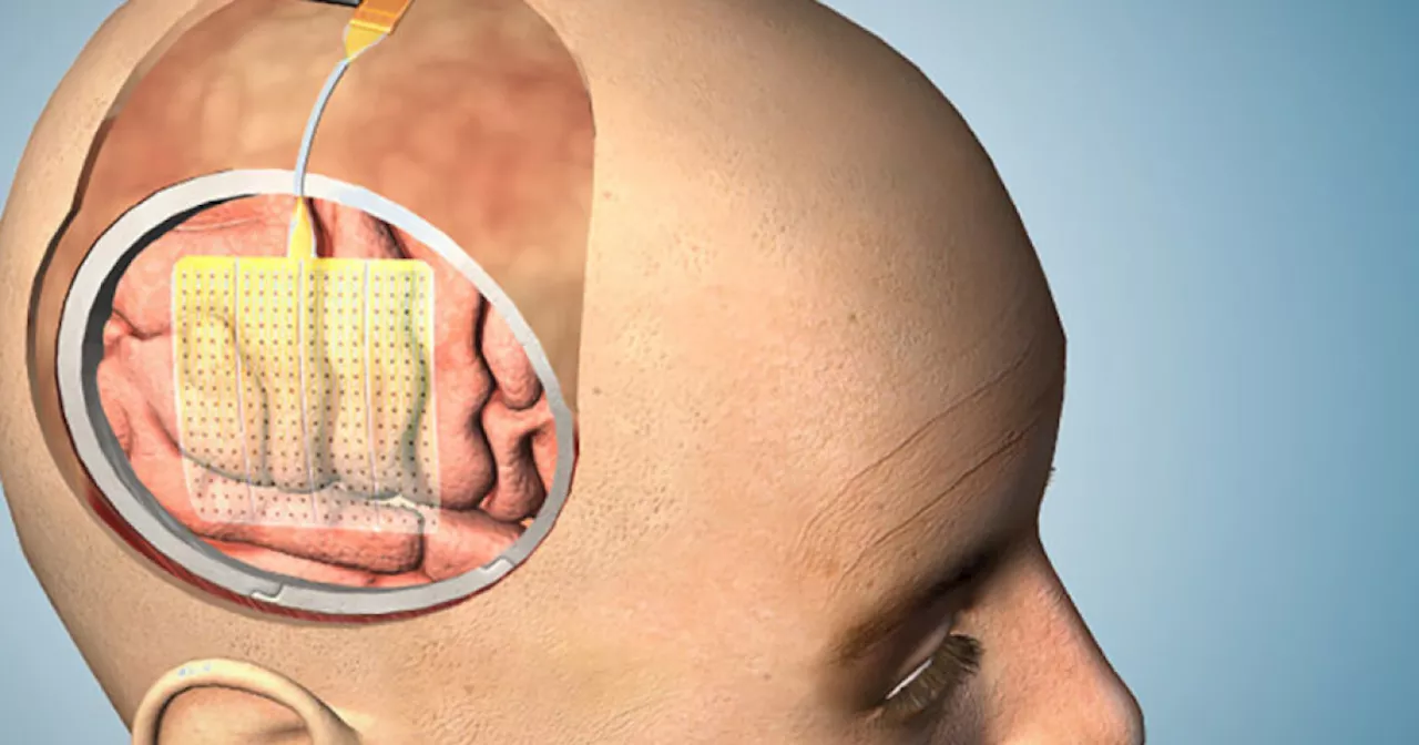 This new brain-mapping device could make neurosurgery safer