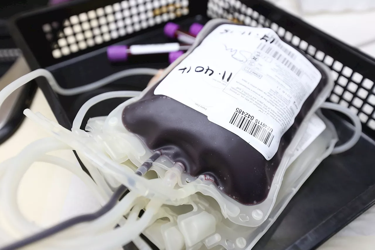 After major traumatic brain injury, more blood transfusions could mean better outcomes