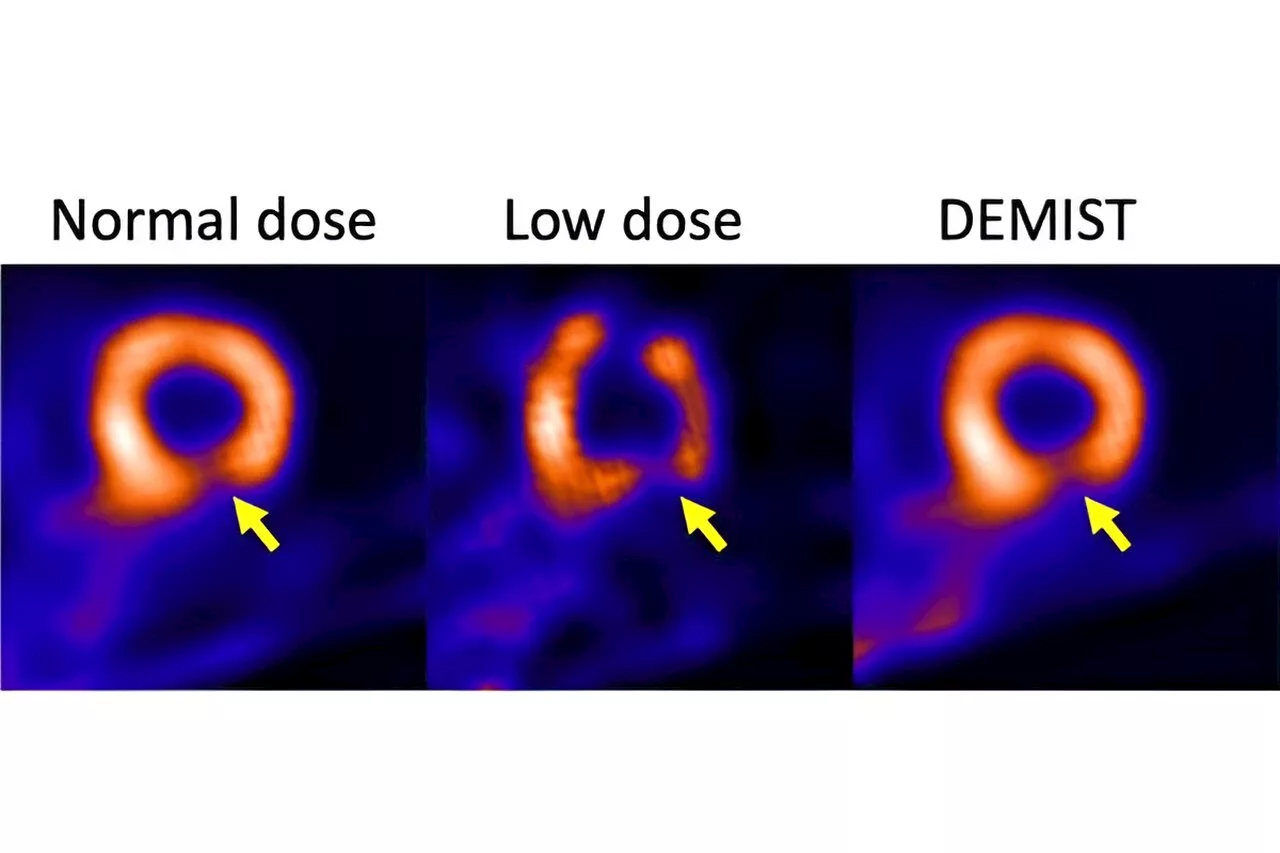 Artificial intelligence tool may enhance usability of medical images