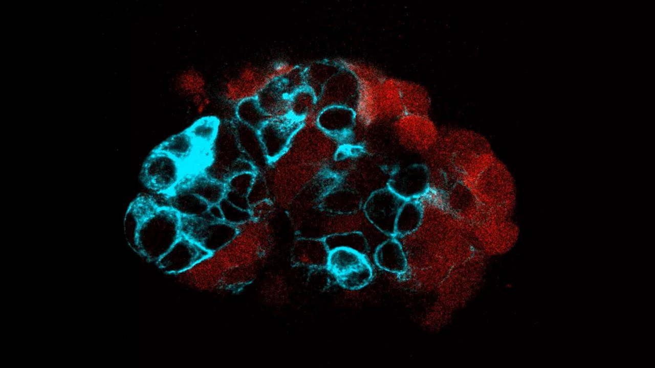 Scientists discover how the physics of colon cancer cells contributes to metastasis