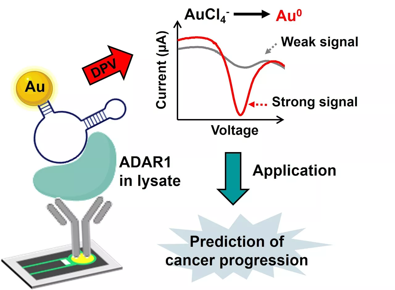 Researchers develop new electrochemical biosensor for cancer prognosis