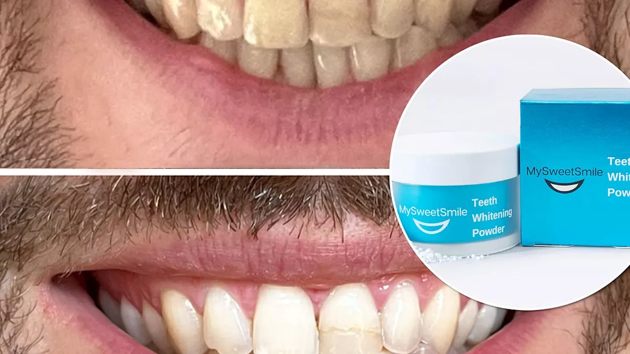 Yellow teeth? Shoppers are wowed by bestselling £24.99 teeth whitening powder leaves smiles whiter...