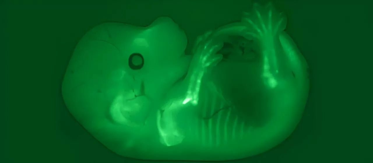 Scientists identify the genetic 'switches' of bone growth