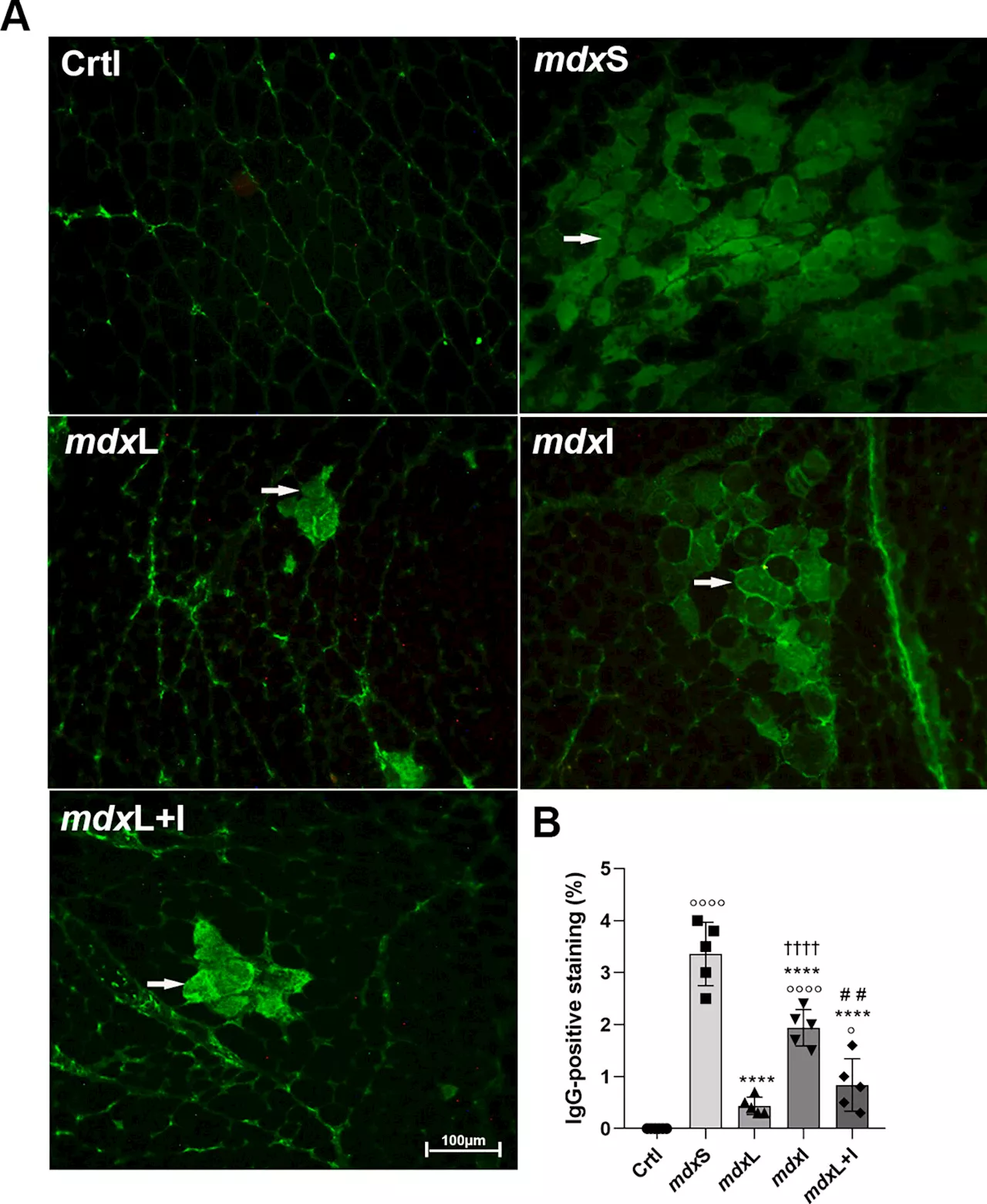 Study finds LED therapy and antioxidant drug benefit muscle regeneration in Duchenne muscular dystrophy