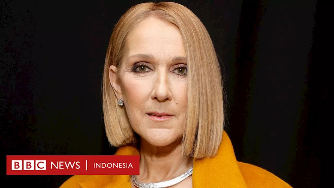 Celine Dion akan kembali naik panggung setelah berjuang melawan sindrom autoimun