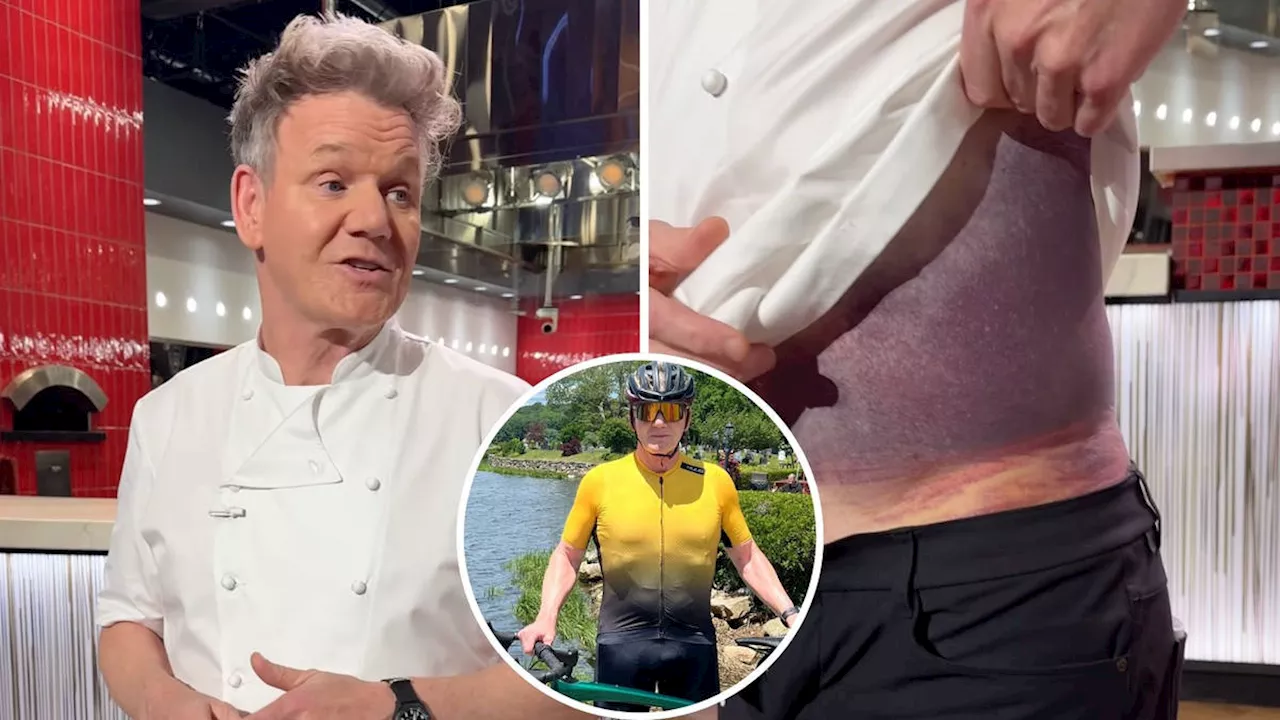 Gordon Ramsay 'lucky to be alive' as star shows off shocking injuries after being involved 'brutal' cycling...