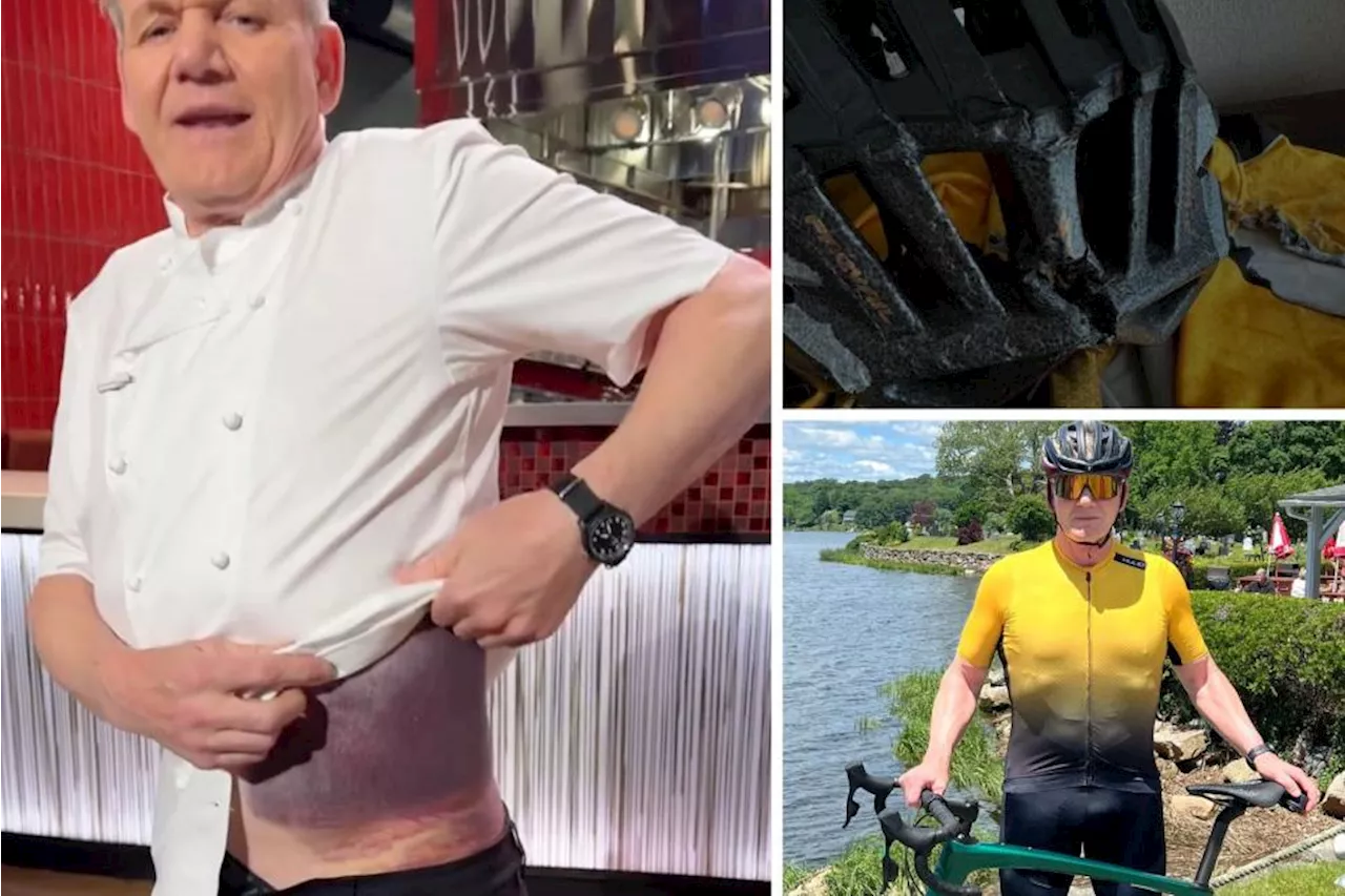 Gordon Ramsay says helmets are “crucial” for cyclists no matter “how short the journey is”, after accident leaves him with a terrible bruise