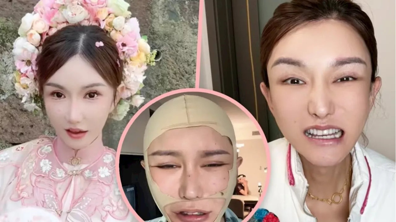 China transgender woman KOL shocks 2.2 million fans with deformed mouth after botched plastic surgery