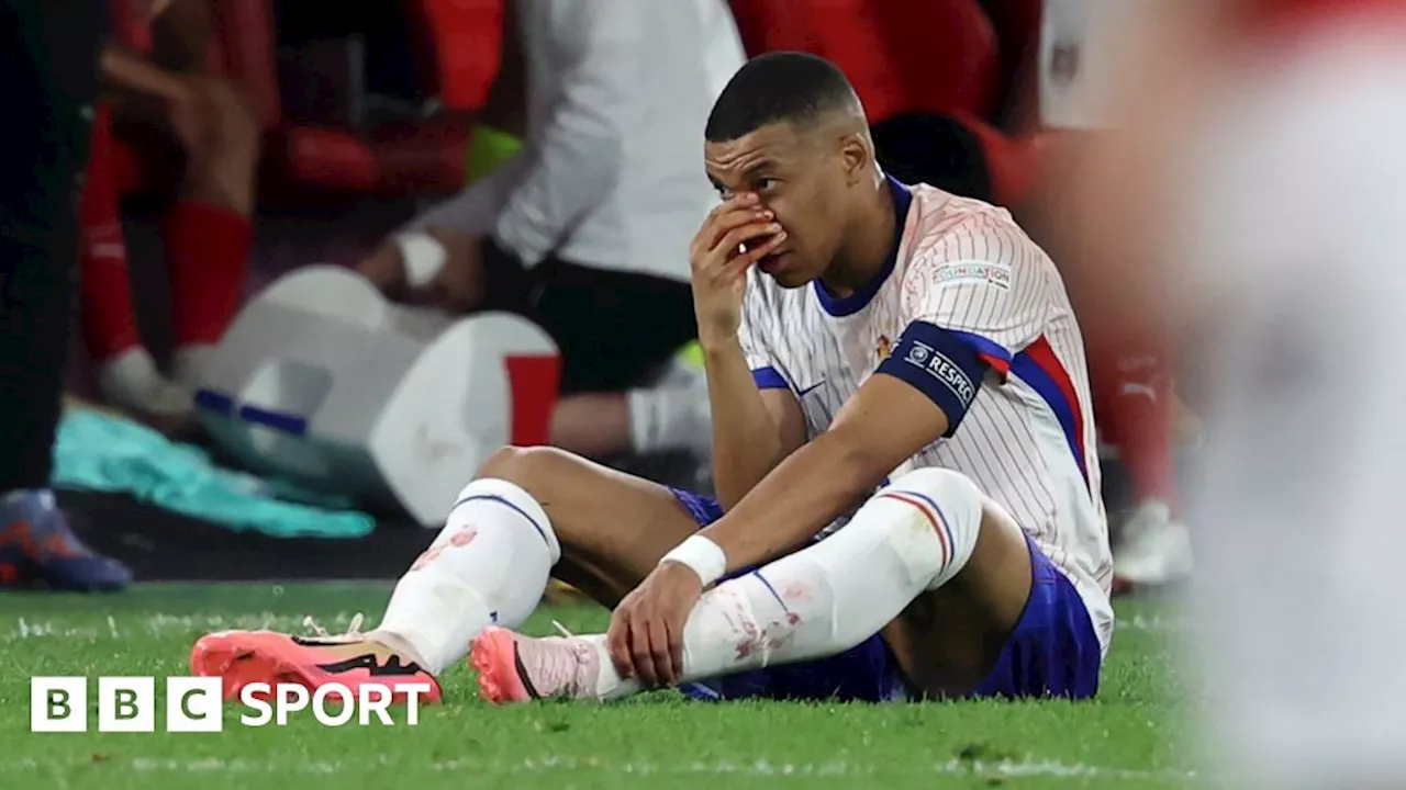 Kylian Mbappe: France captain 'not doing well' after nose injury