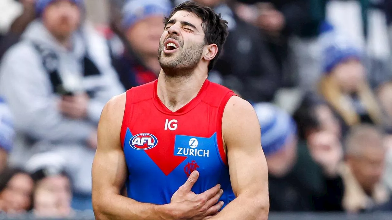 ‘Still raw’: Dees star breaks silence on gruesome details of ‘traumatic’ car crash-like injury