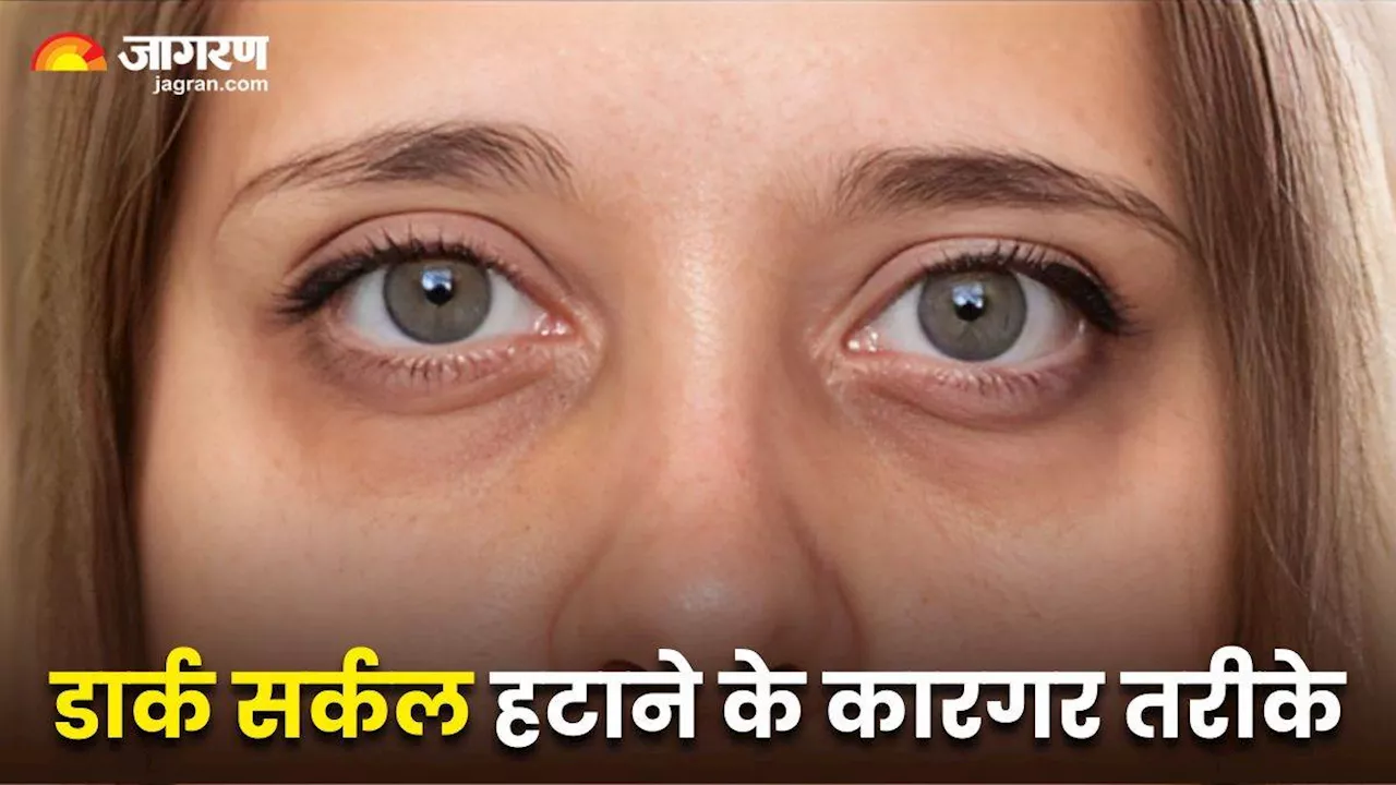 जिद्दी से जिद्दी Dark Circles को हटाने में बेहद कारगर हैं ये दो तरीके, कुछ ही दिनों में दिखने लगेगा फर्क!