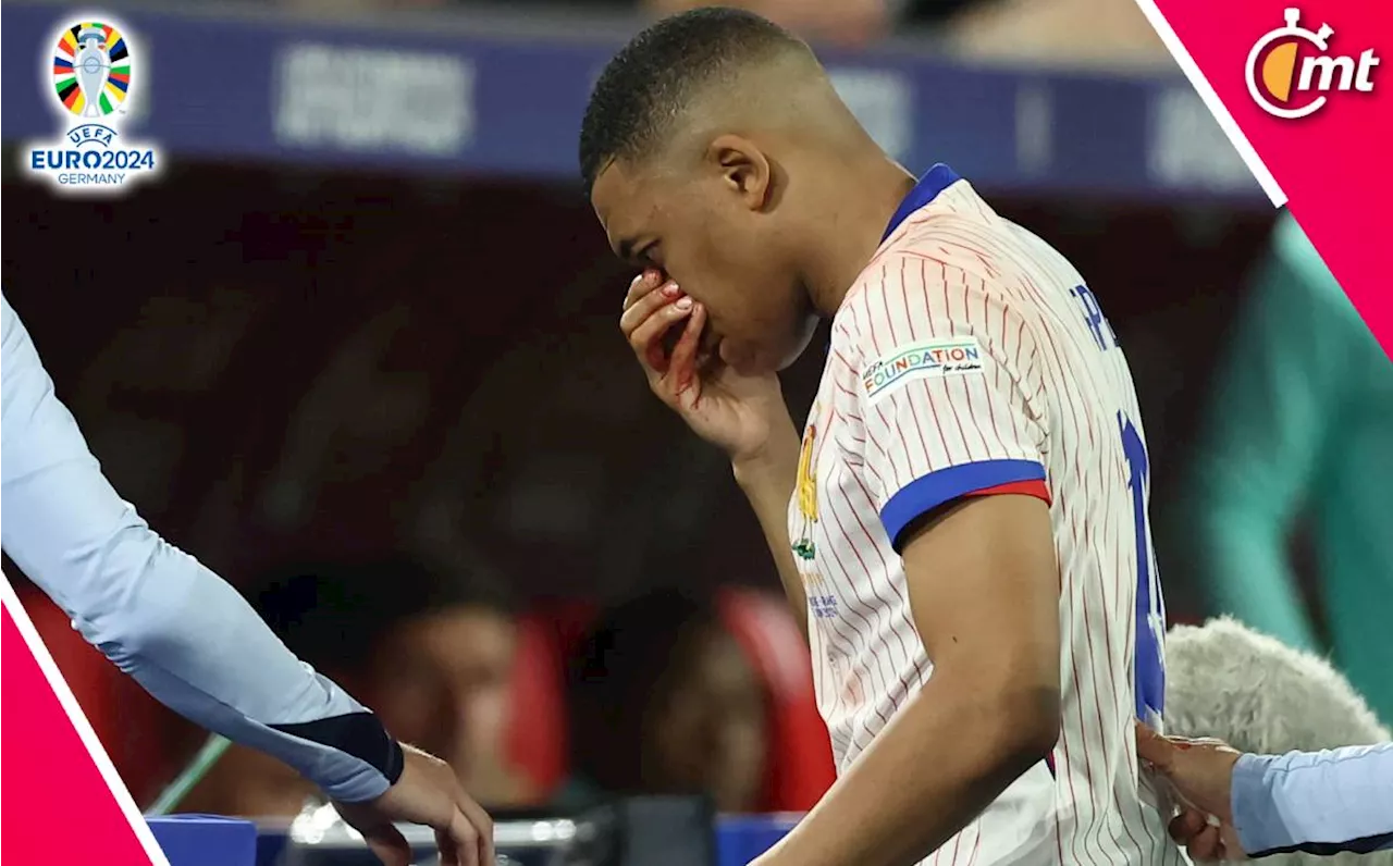 Confirman fractura de nariz de Kylian Mbappé tras el Austria vs. Francia en la Euro 2024