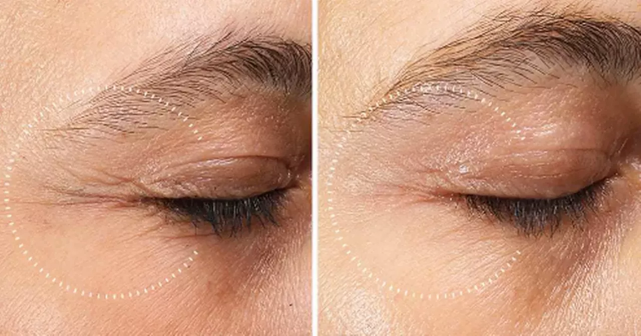 Beauty buffs hail 'magic' sagging eye serum after 'instant age-reversing result'