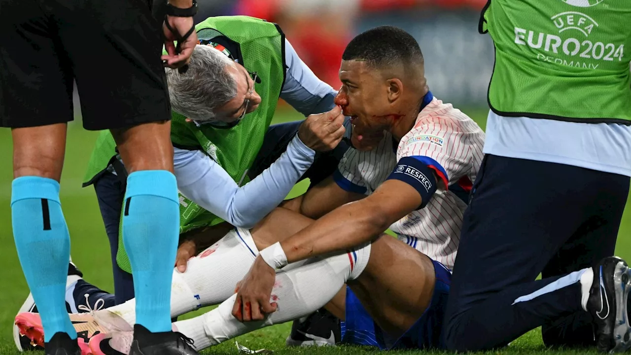 Frankreich schlägt Österreich -aber Sorgen um Topstar Mbappé