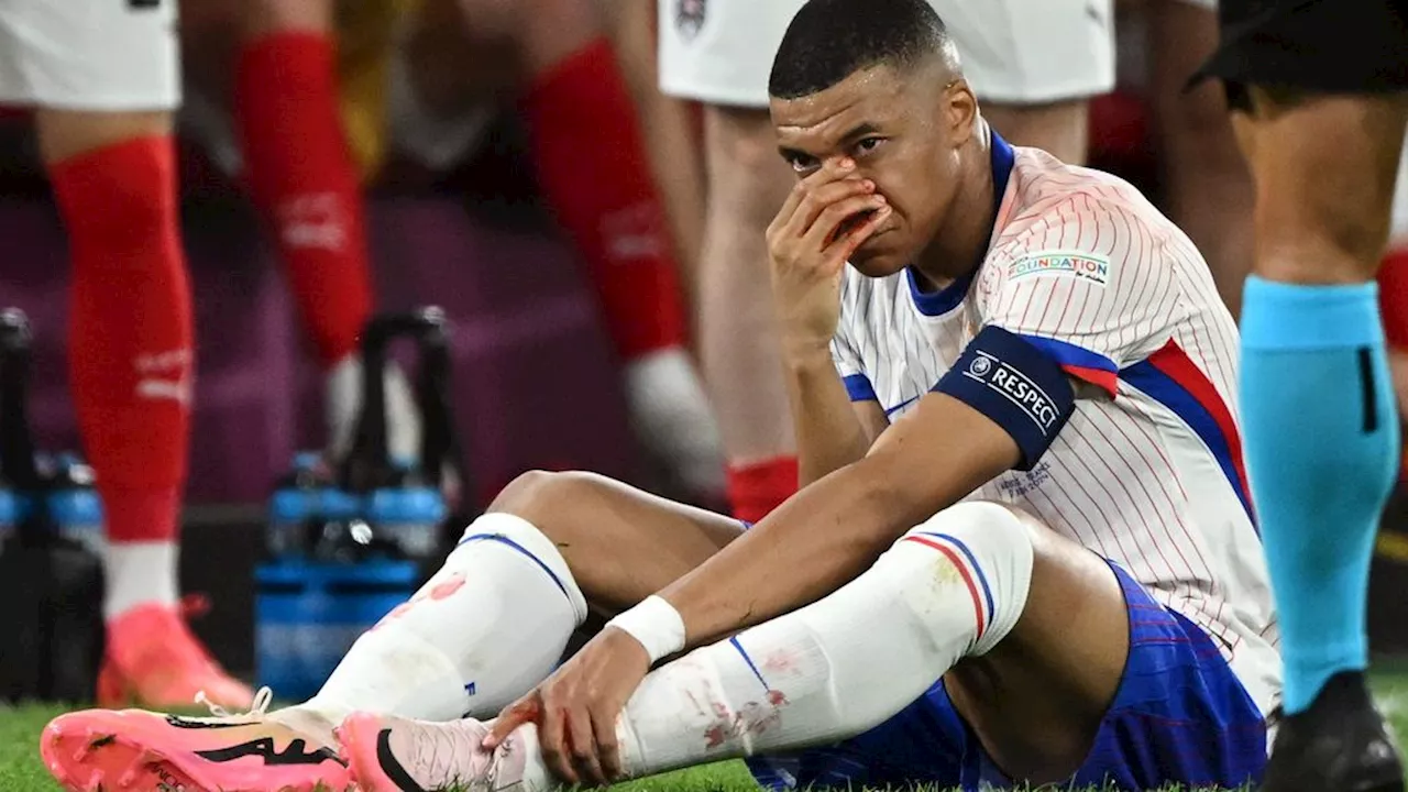 Haalt Mbappé de wedstrijd tegen Oranje? • Sterspeler heeft 'gebroken neus'