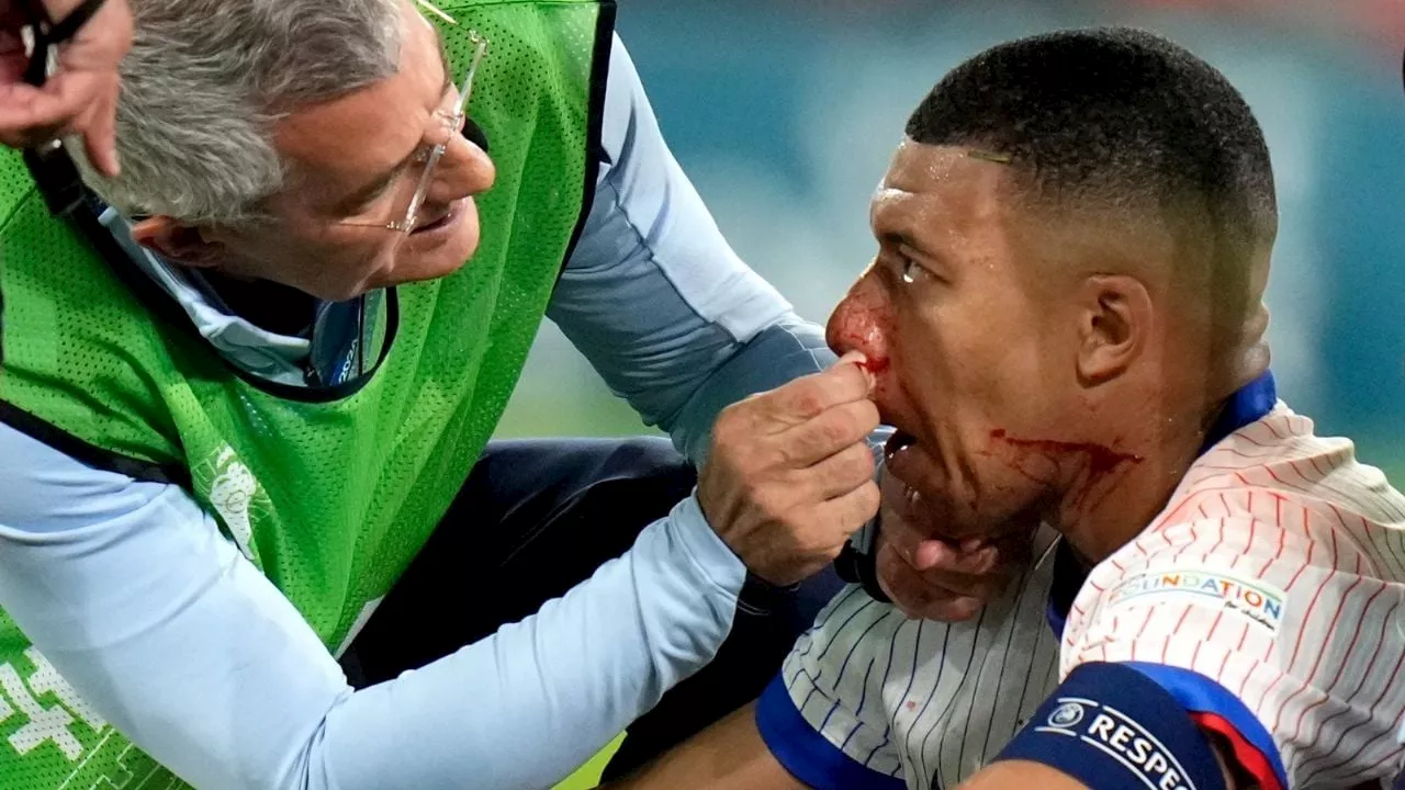 Así fue la jugada donde Mbappé se quebró la nariz en la Eurocopa (Video)