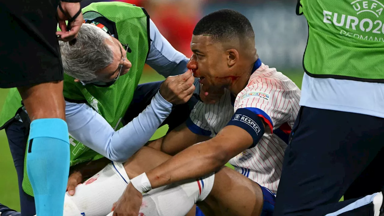 France-Autriche: inquiétude pour Mbappé, le nez en sang et probablement cassé