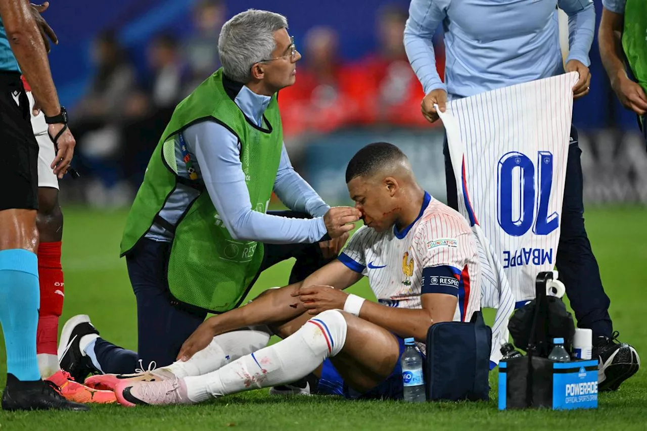 Euro 2024 : Kylian Mbappé sort avec le nez cassé à la fin de France