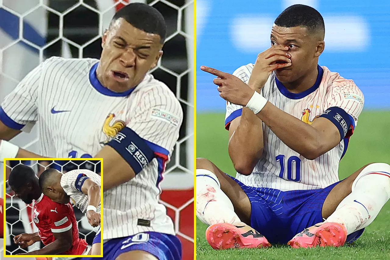 Kylian Mbappe suffers suspected broken nose as Didier Deschamps gives worrying update on France superstar...