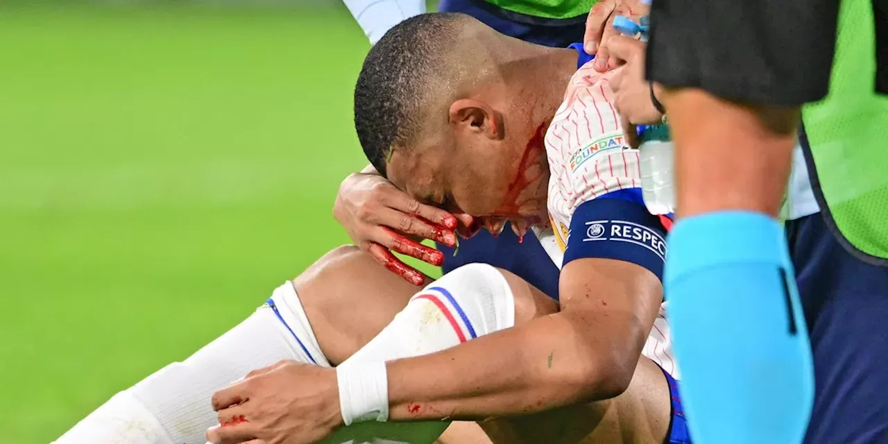 Franse bond: Mbappé moet onder het mes voor duel met Oranje door gebroken neus