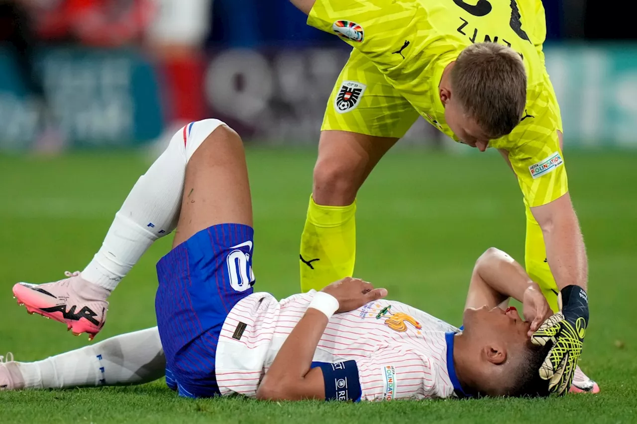 Kylian Mbappé sustained a broken nose at Euro 2024, but France gets 'positive' news