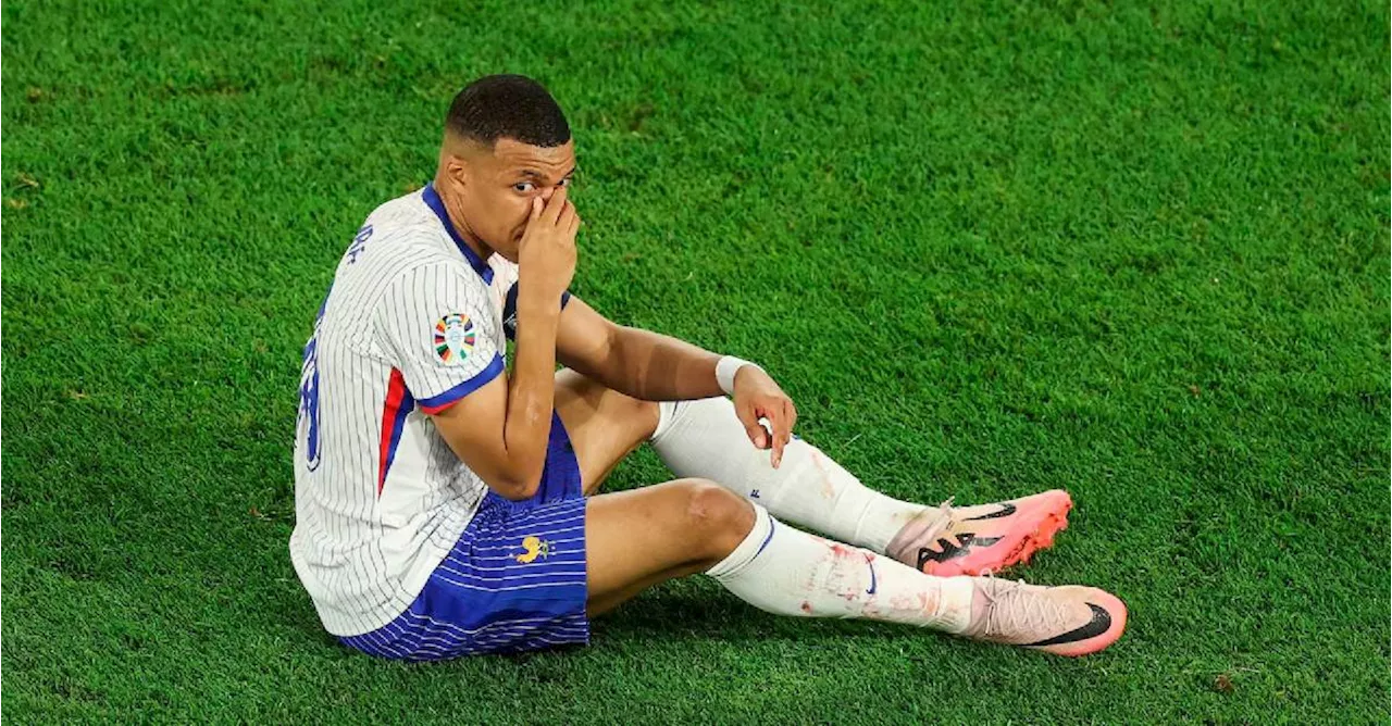 Kylian Mbappé finalmente no será operado tras fracturarse la nariz