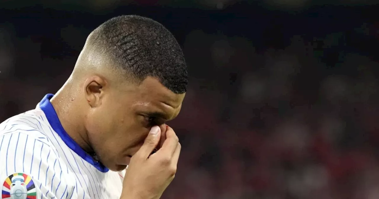 “Tendrá que hacerla”: Deschamps sobre operación en la nariz de Mbappé