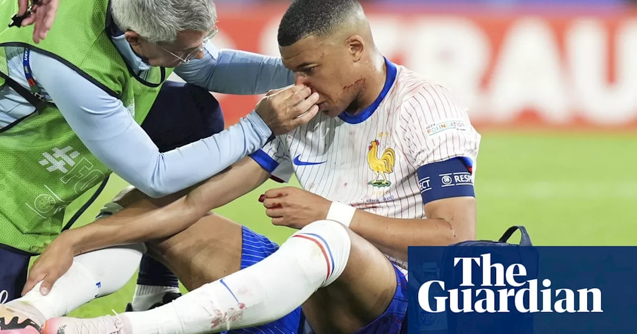 Kylian Mbappé could miss rest of Euro 2024 group stage due to broken nose