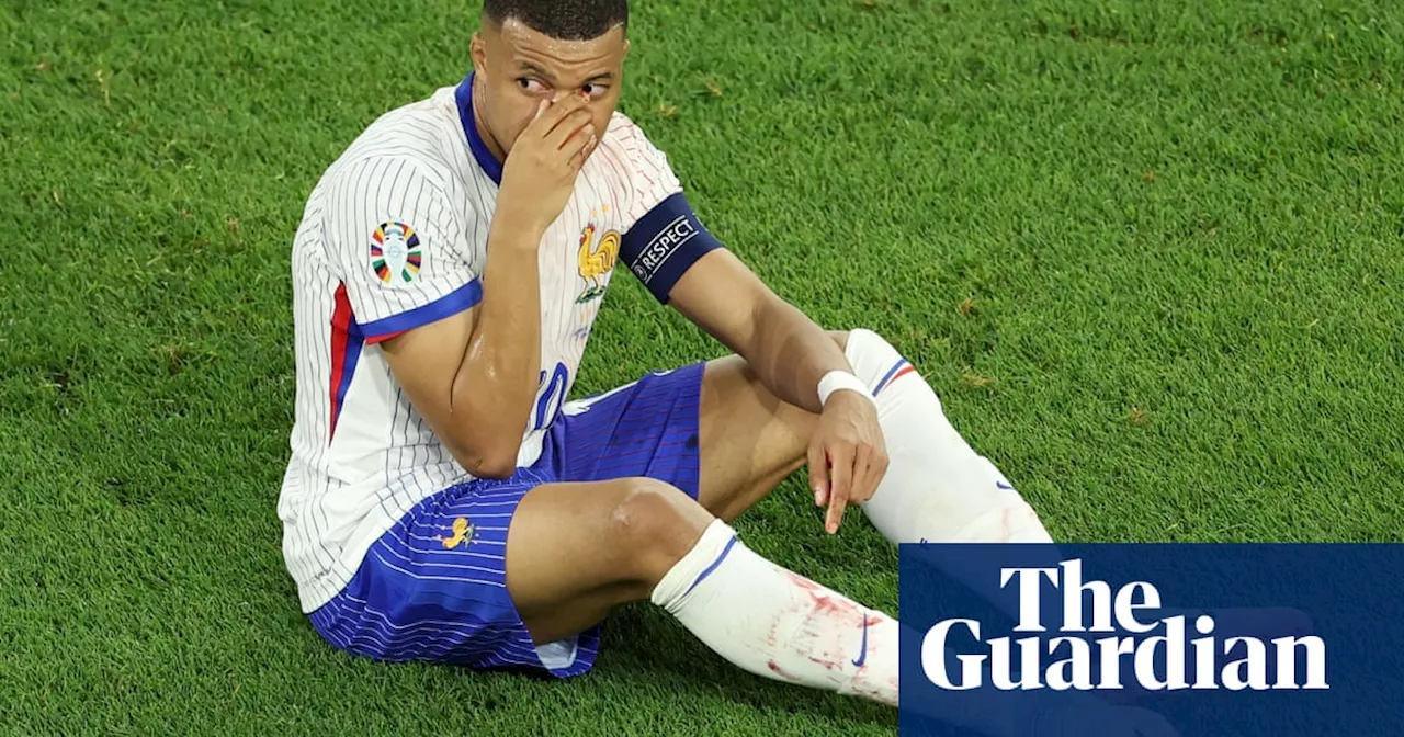 Kylian Mbappé suffers broken nose and is doubt for game against Netherlands