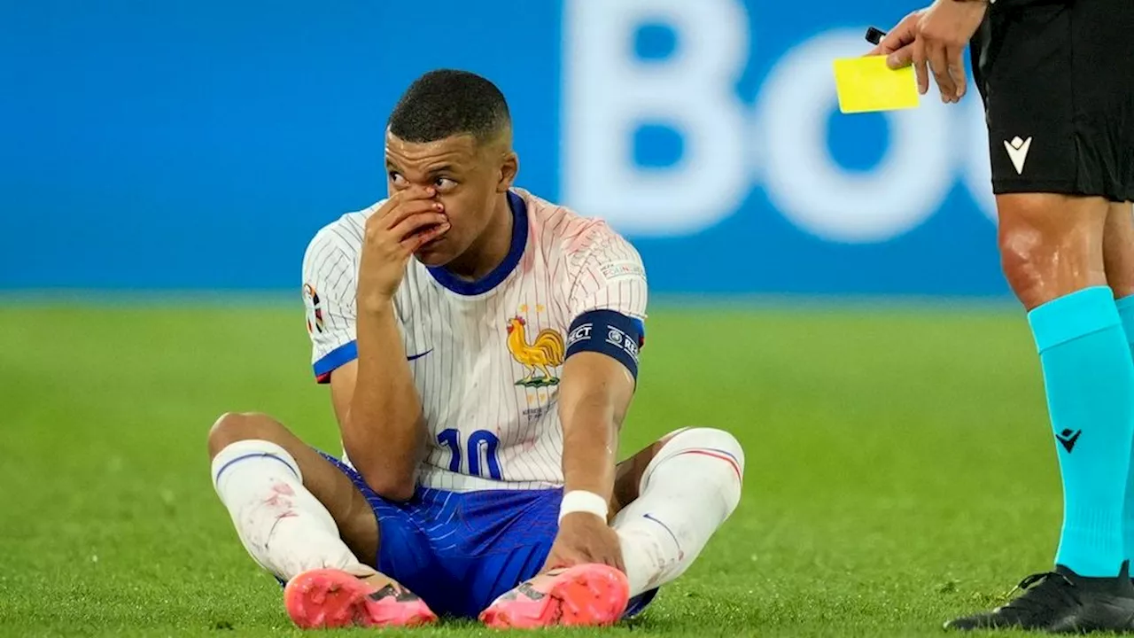 Cedera Hidung, Mengapa Mbappe Dihukum Kartu Kuning?