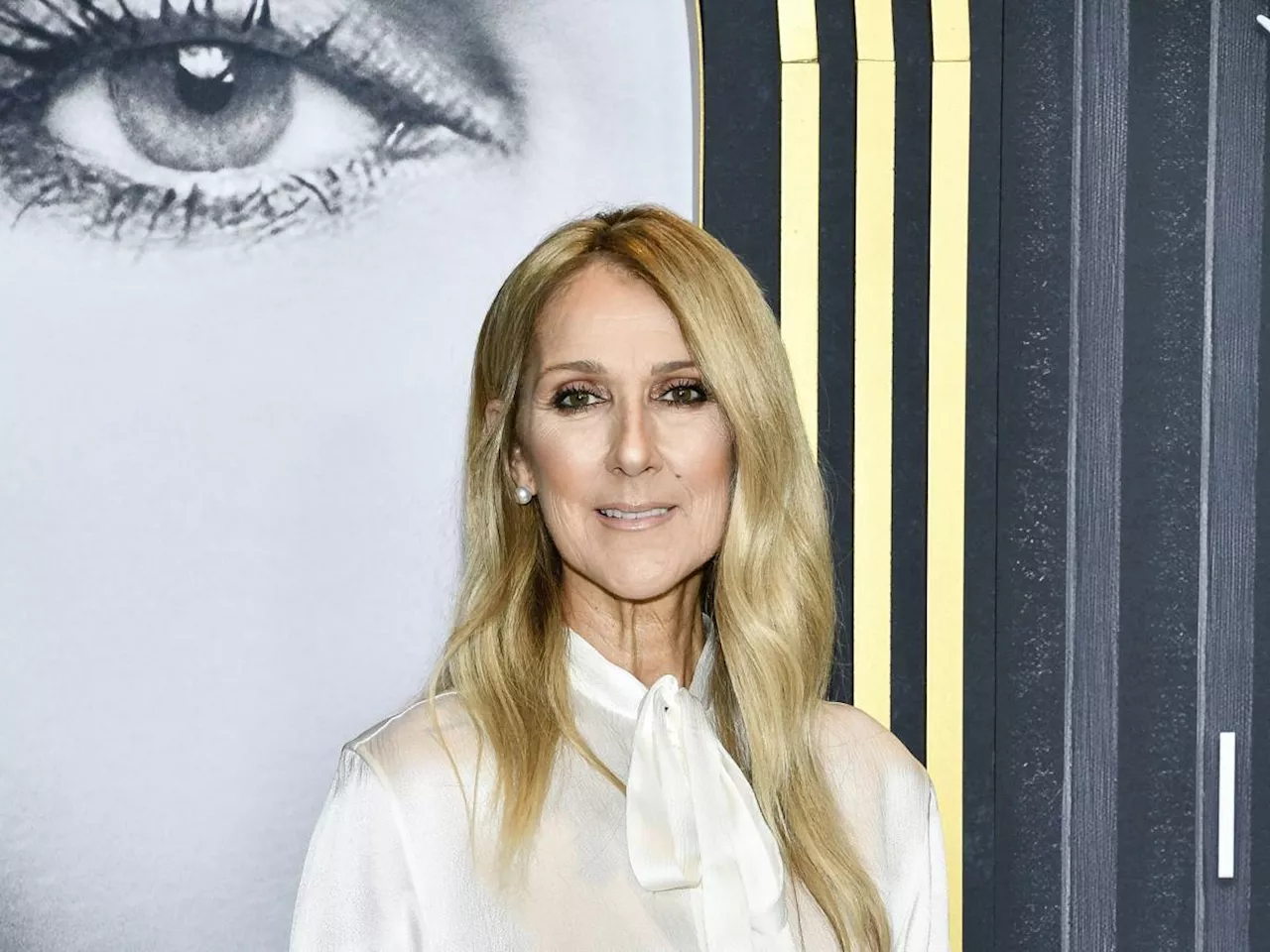 Cos'è la sindrome dell'uomo rigido che ha colpito Celine Dion: sintomi e cure