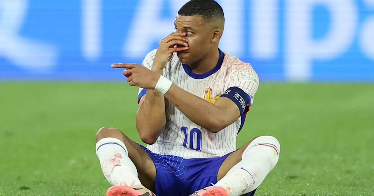 Kylian Mbappé to play in mask at Euros after France star sustains broken nose