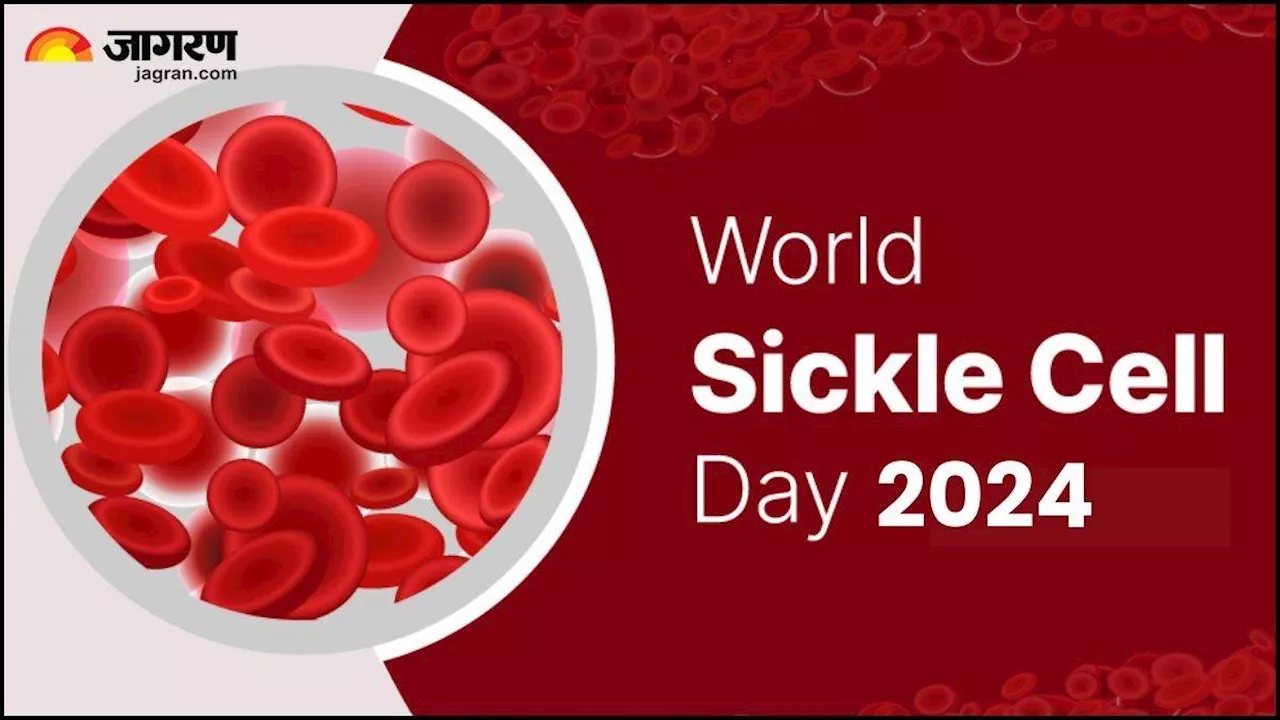 World Sickle Cell Day 2024: क्या है सिकल सेल बीमारी, जानें इसके लक्षण, बचाव और उपचार के तरीके