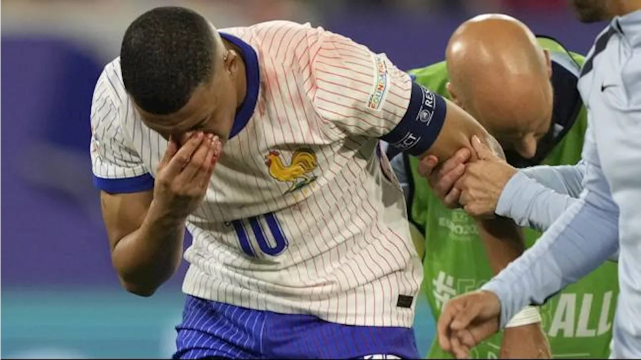 Euro 2024: Mbappe Terhindar dari Operasi usai Alami Cedera Hidung, Berpeluang Tampil Lawan Belanda