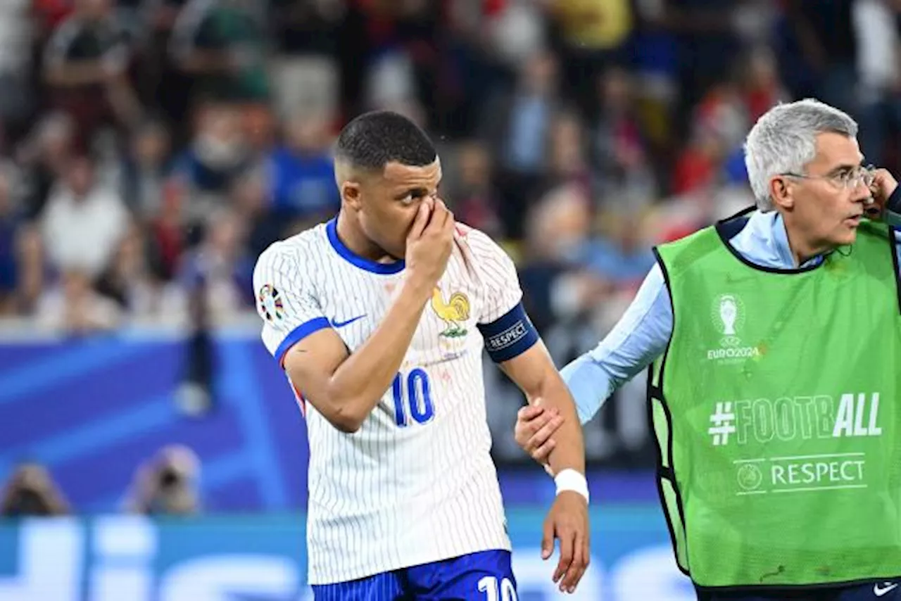 Euro 2024 : pas d'opération dans l'immédiat pour la fracture du nez de Kylian Mbappé